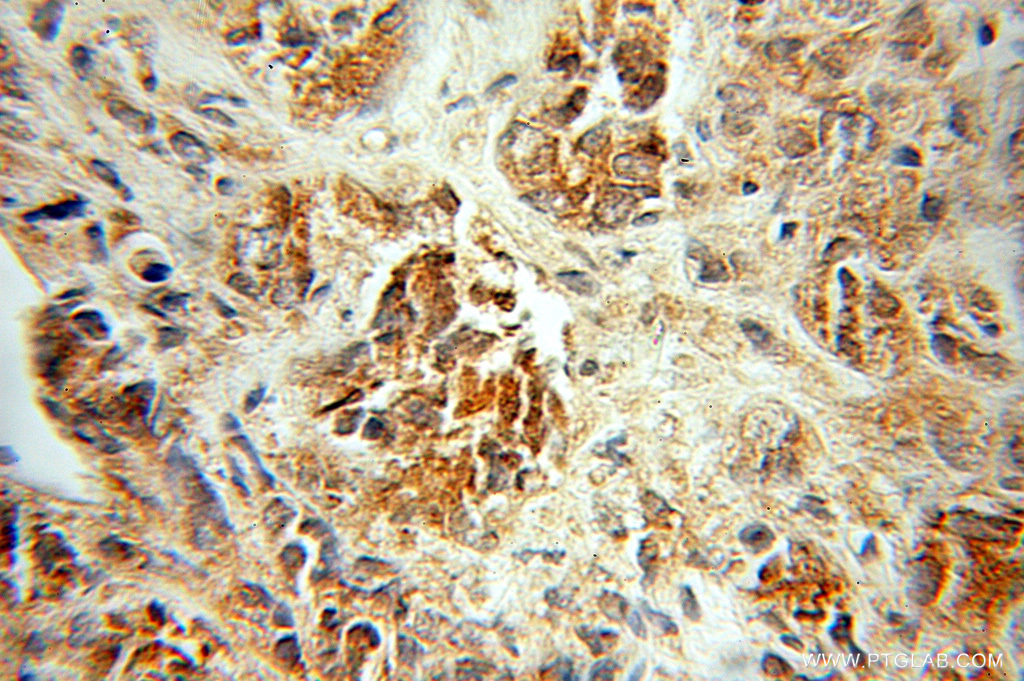 PDLIM5 Polyclonal antibody