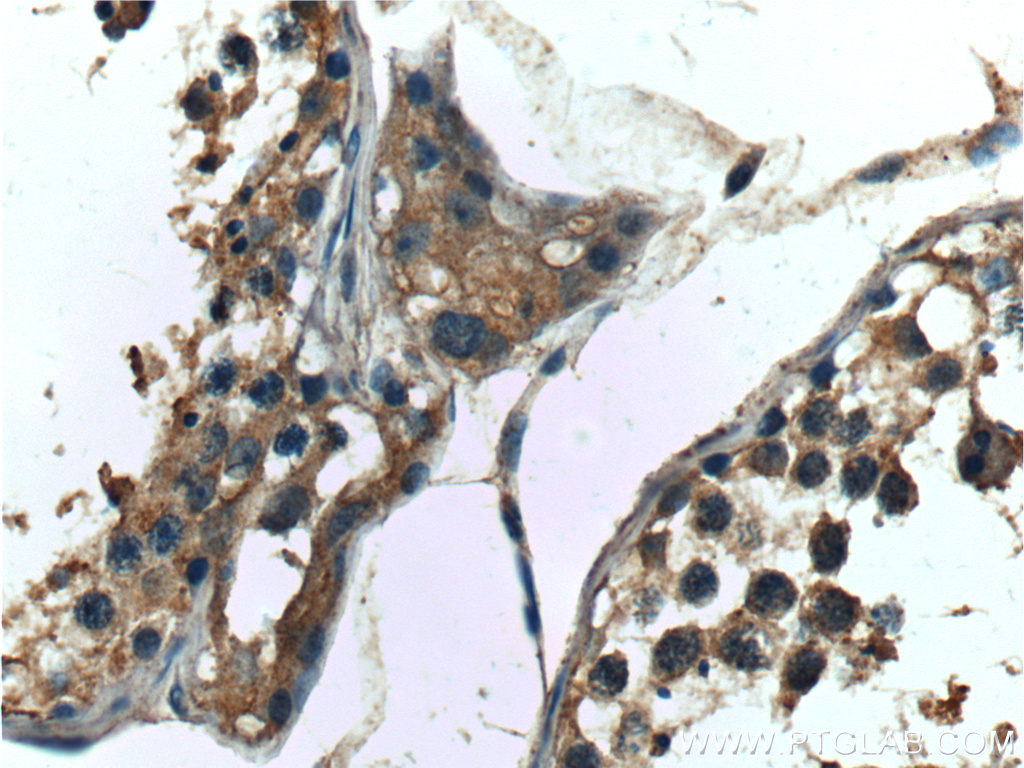 DDR1 Polyclonal antibody