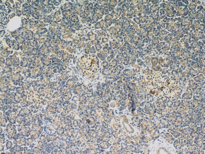 Dermatopontin Polyclonal antibody