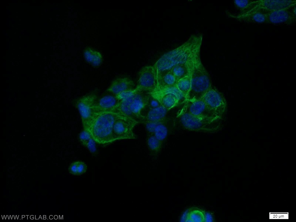 HIC5 Polyclonal antibody