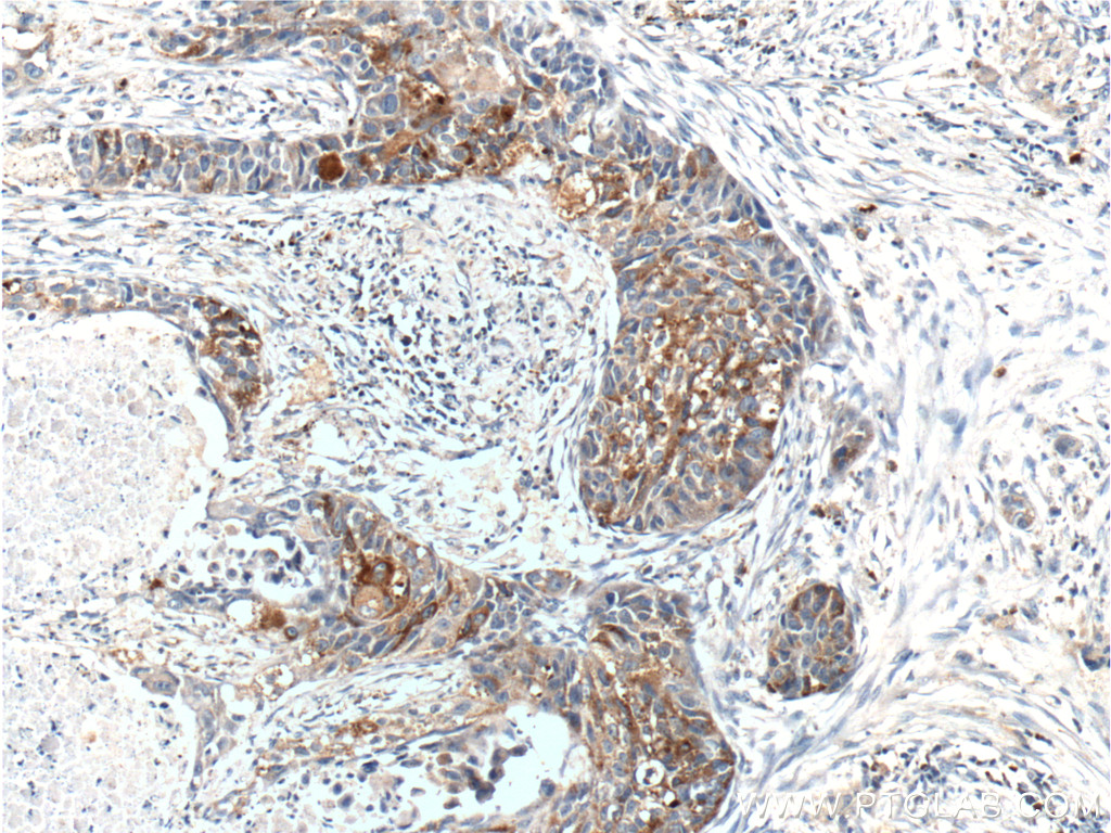 RPN2 Polyclonal antibody