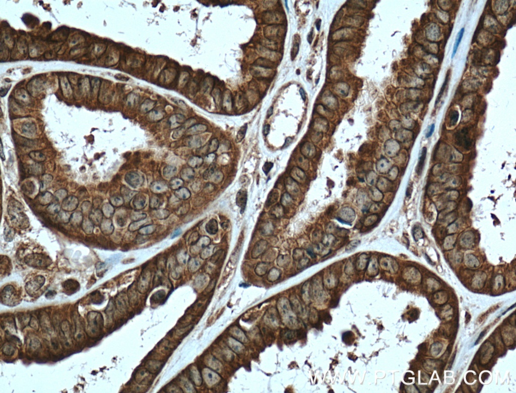 APOBEC3C Polyclonal antibody