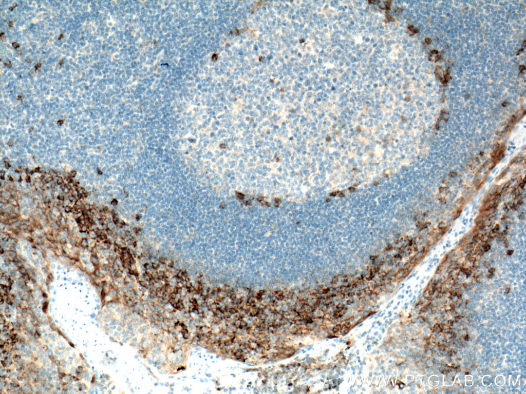 CD138/Syndecan-1 Polyclonal antibody