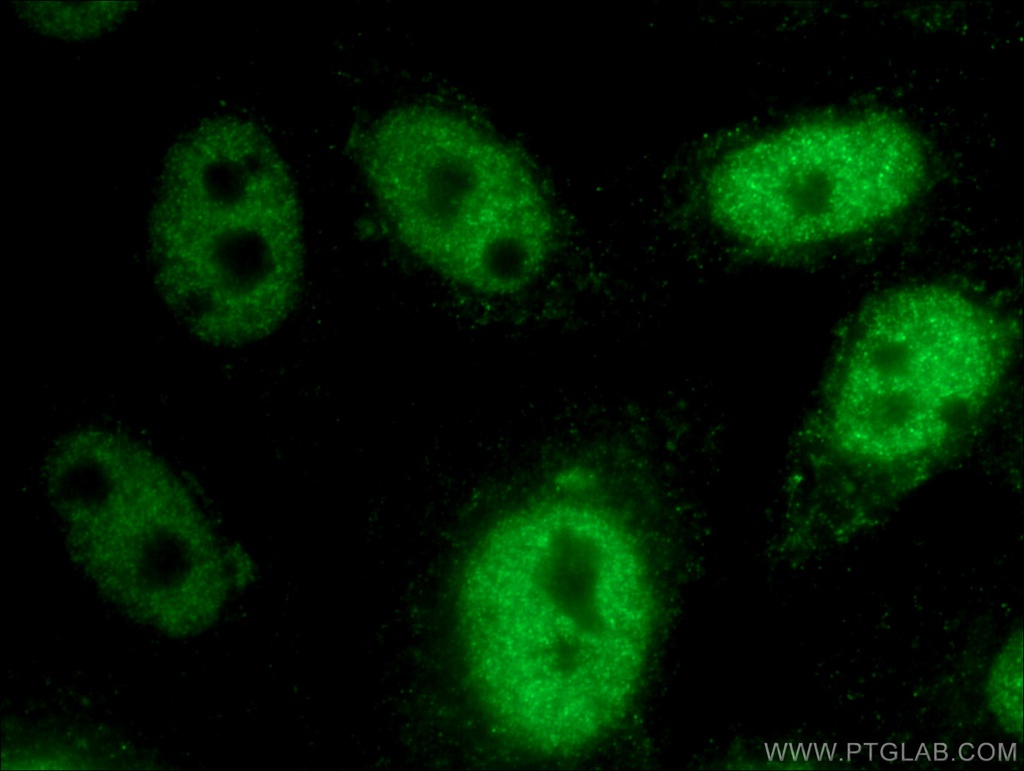 HEY2 Polyclonal antibody