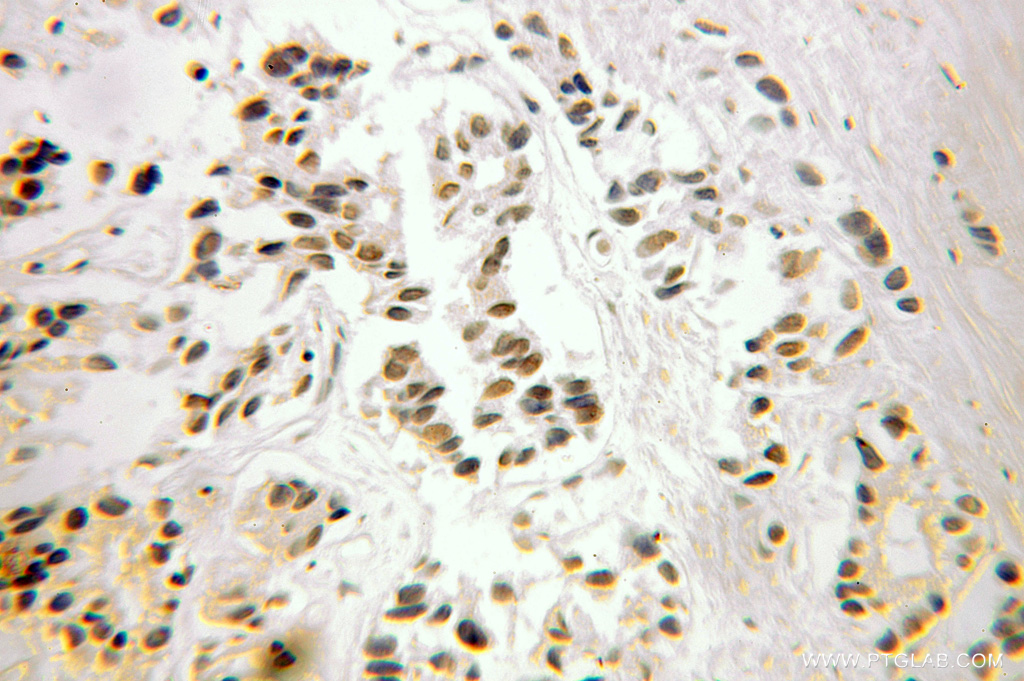 FUBP3 Polyclonal antibody