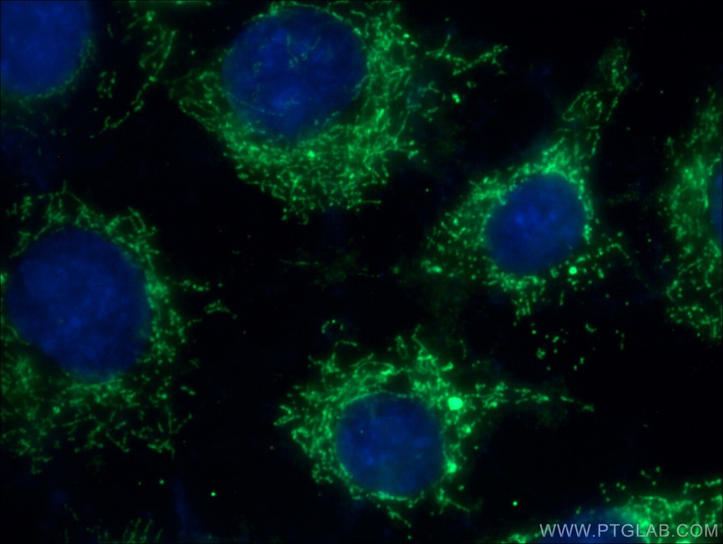 FADS1 Polyclonal antibody