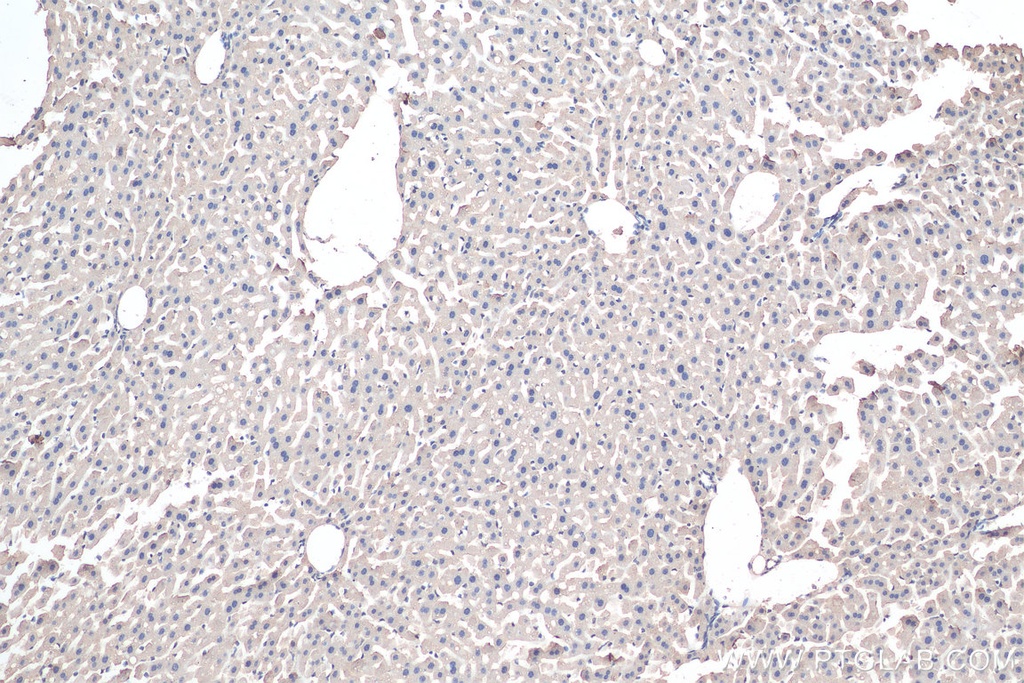 Aminomethyltransferase Polyclonal antibody