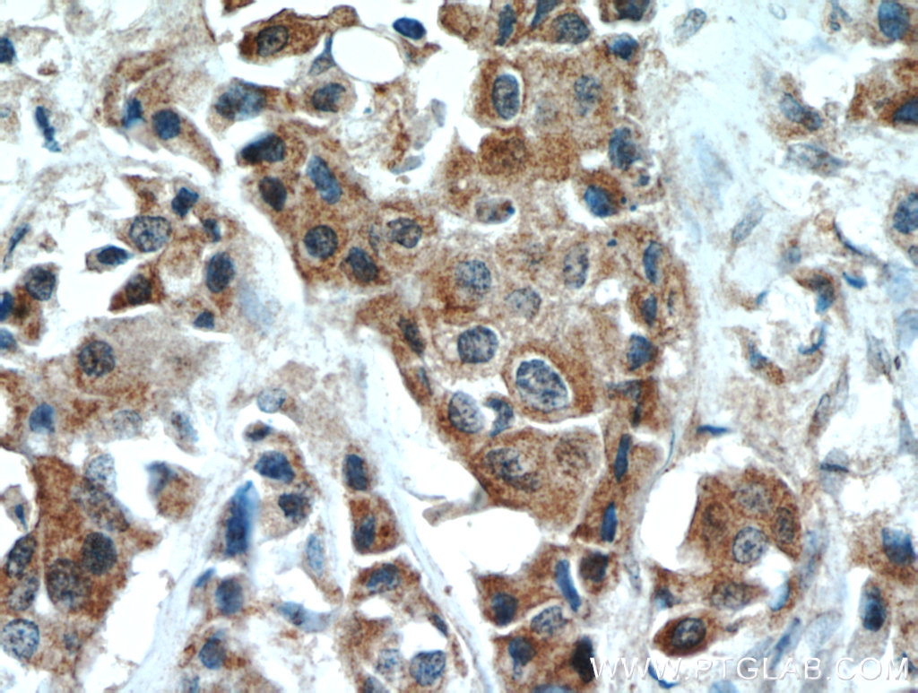 DLK1 Polyclonal antibody