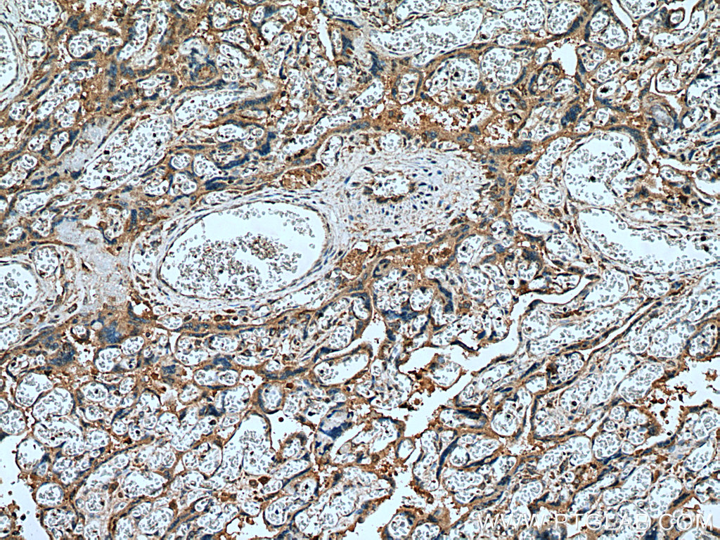 Placental Growth Factor Polyclonal antibody