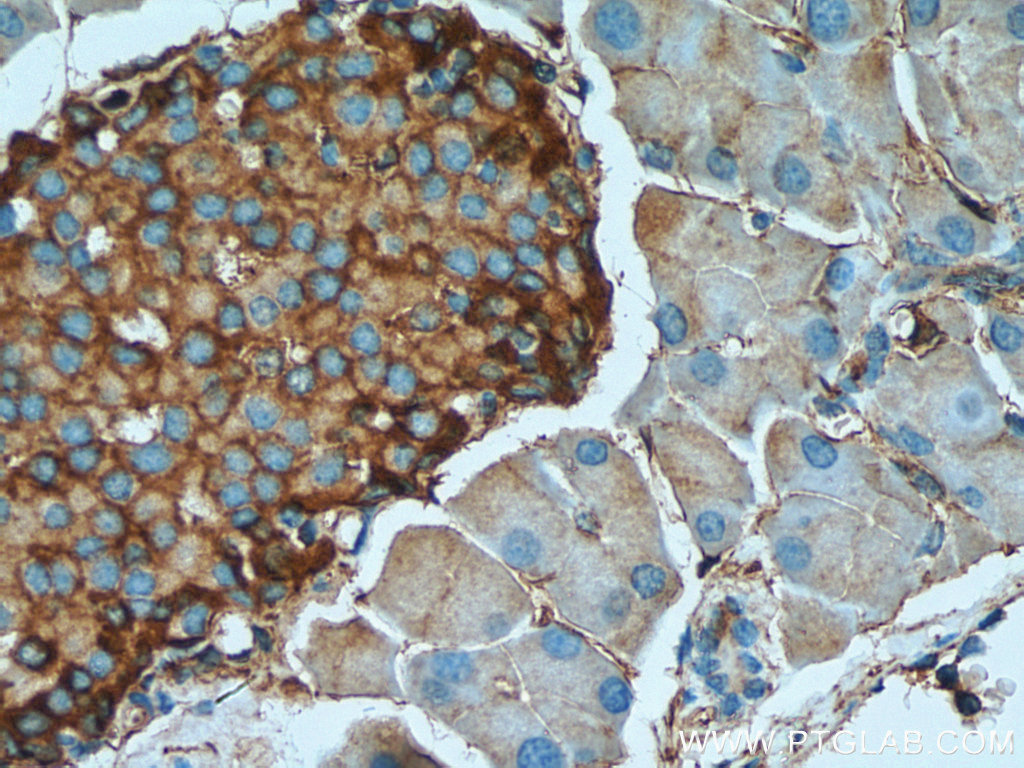 Marcks Polyclonal antibody
