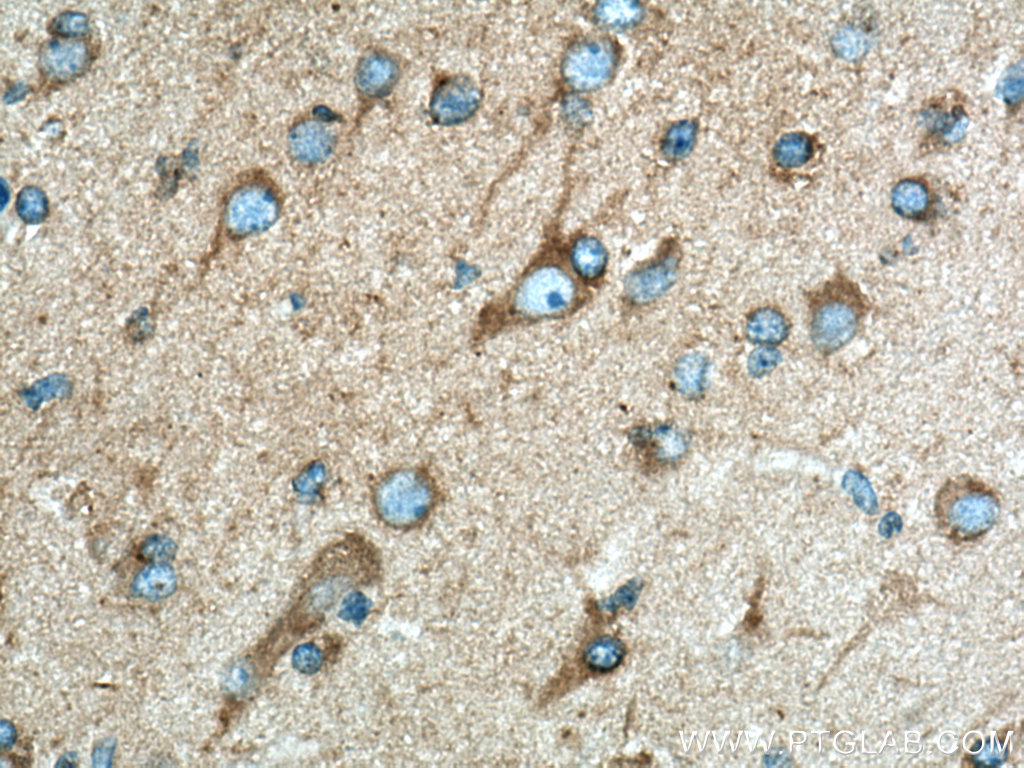 Dynamitin (69-376 AA) Polyclonal antibody