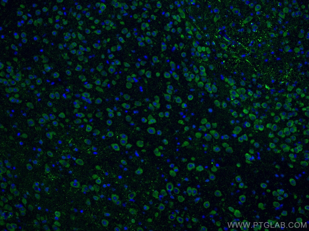 Notch1 Polyclonal antibody