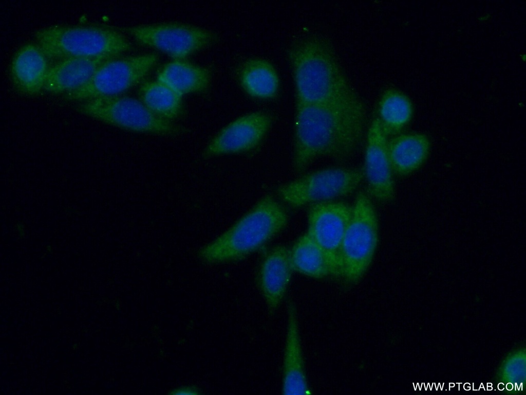 PKM Polyclonal antibody