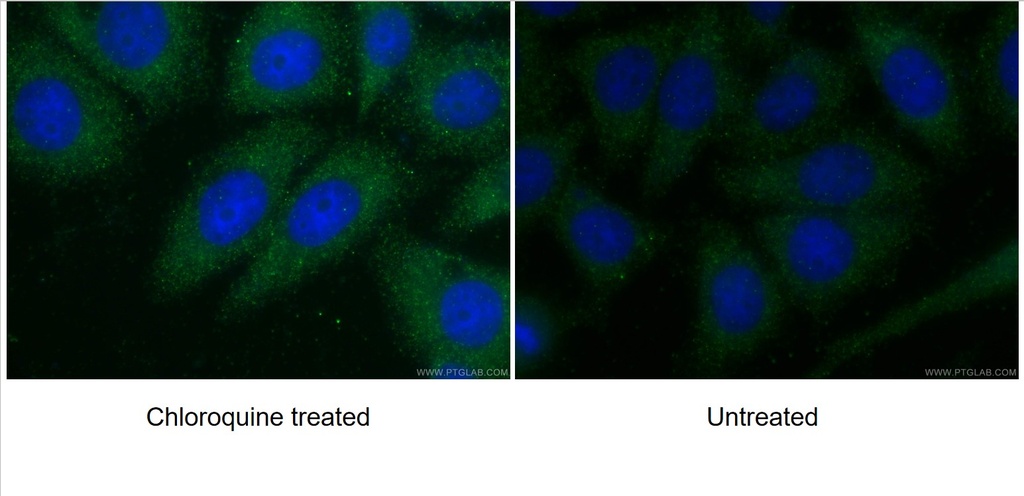 ATG7 Polyclonal antibody
