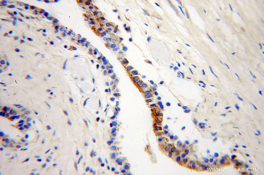ARL2BP Polyclonal antibody