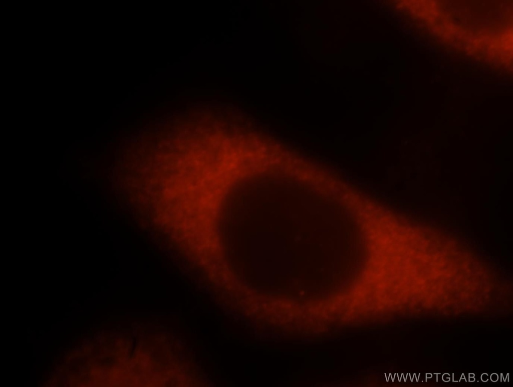 EEF1B2 Polyclonal antibody