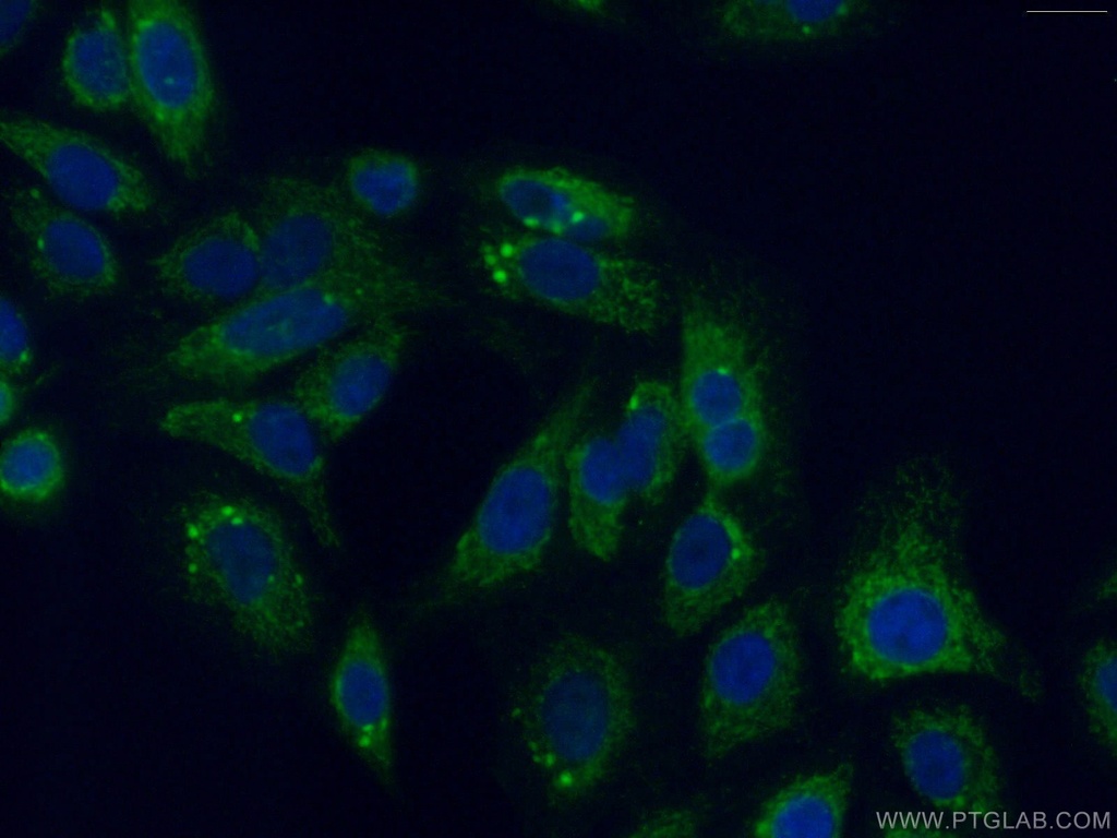 PITRM1 Polyclonal antibody
