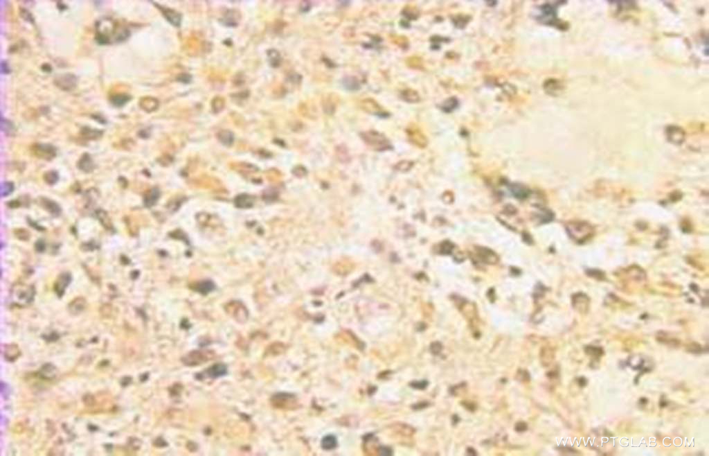 GPAA1 Polyclonal antibody
