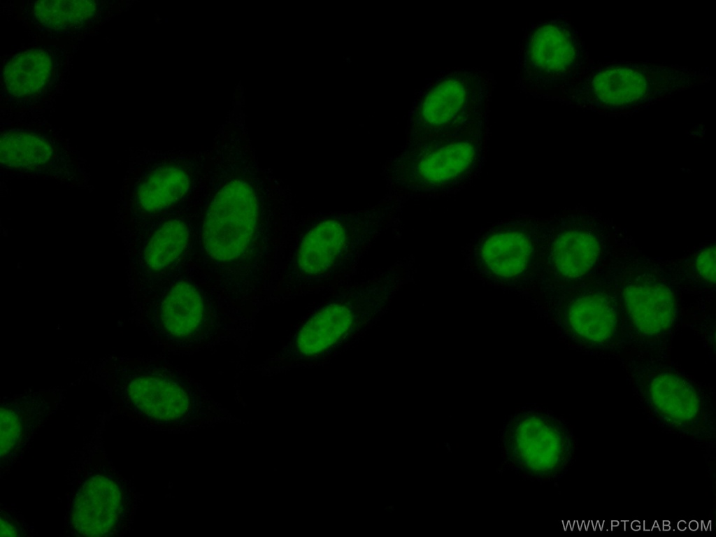 UBE2T/HSPC150 Polyclonal antibody