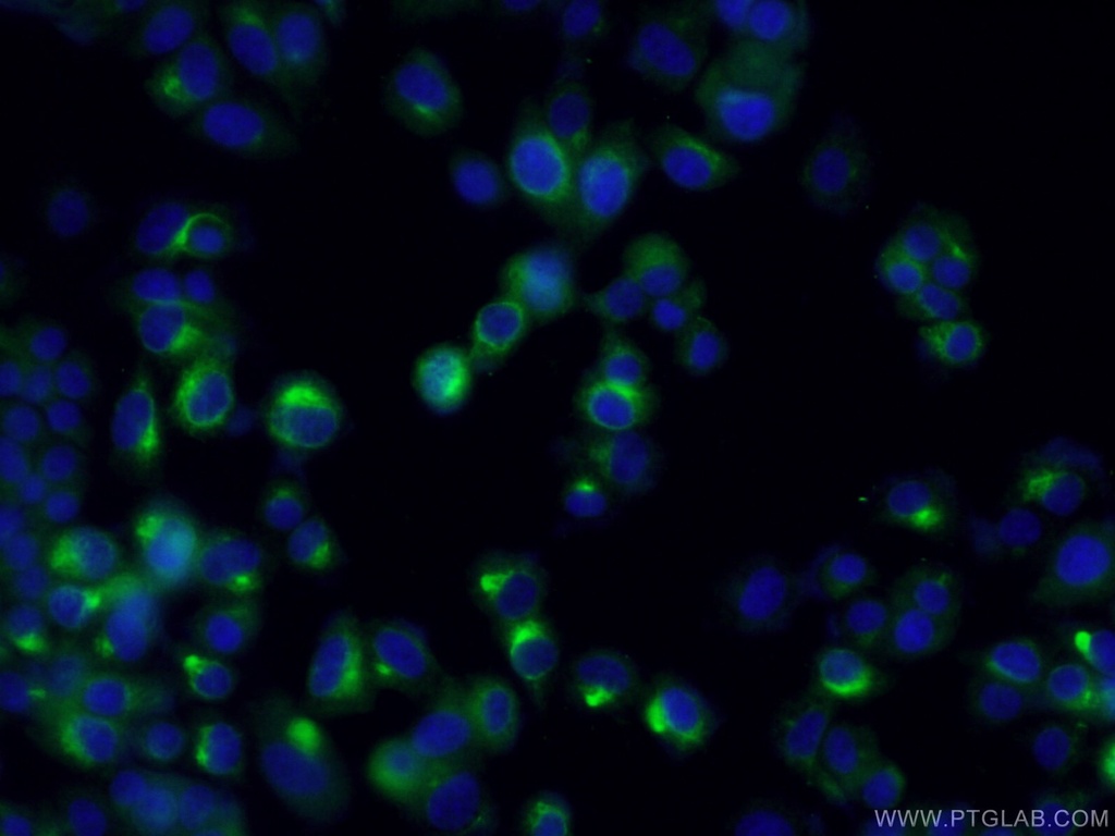 NUMBL Polyclonal antibody