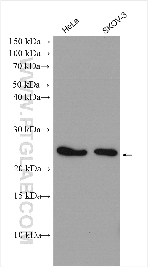 LDOC1 Polyclonal antibody