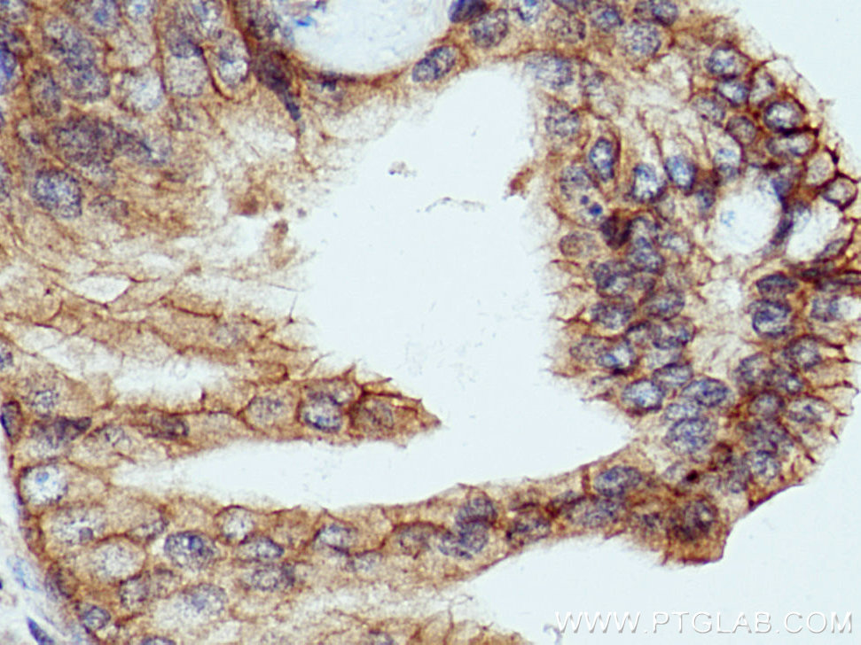 LRRC1 Polyclonal antibody