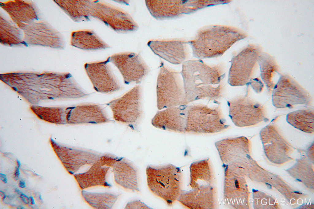 VAMP2 Polyclonal antibody