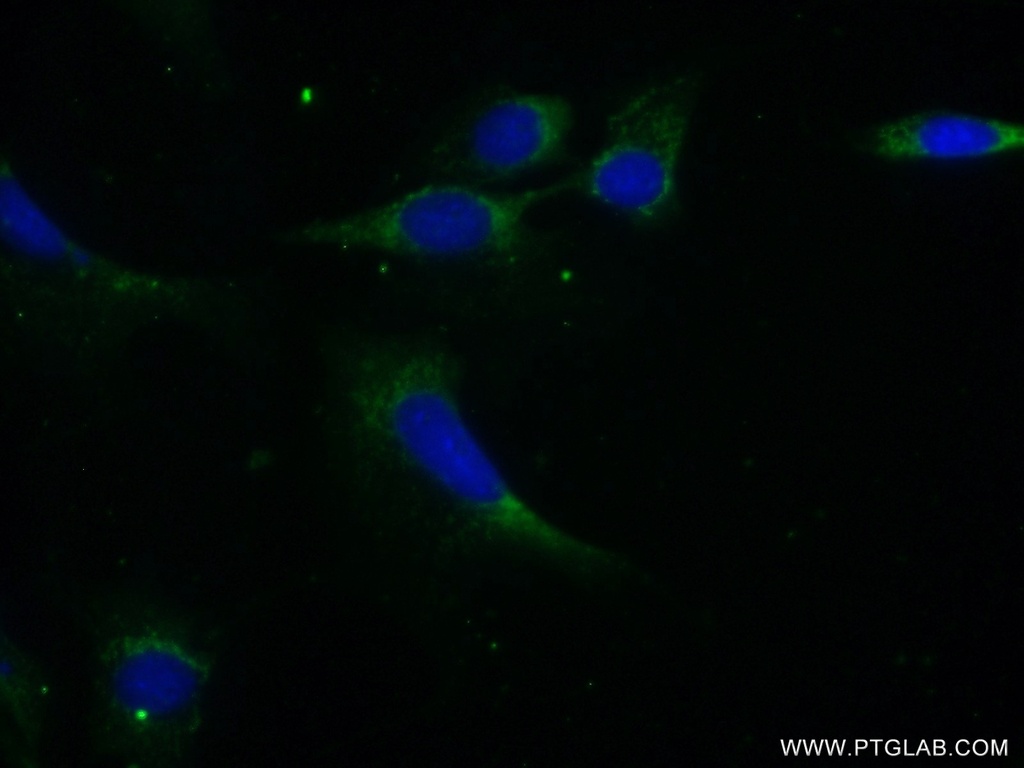 PPP1CB-Specific Polyclonal antibody