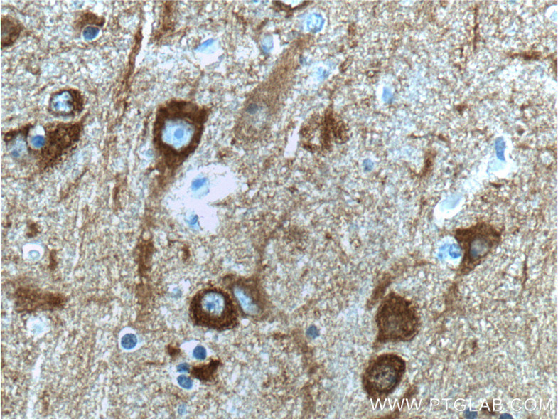 NSE Polyclonal antibody
