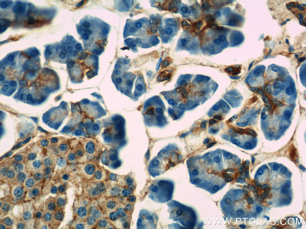 Annexin VII Polyclonal antibody