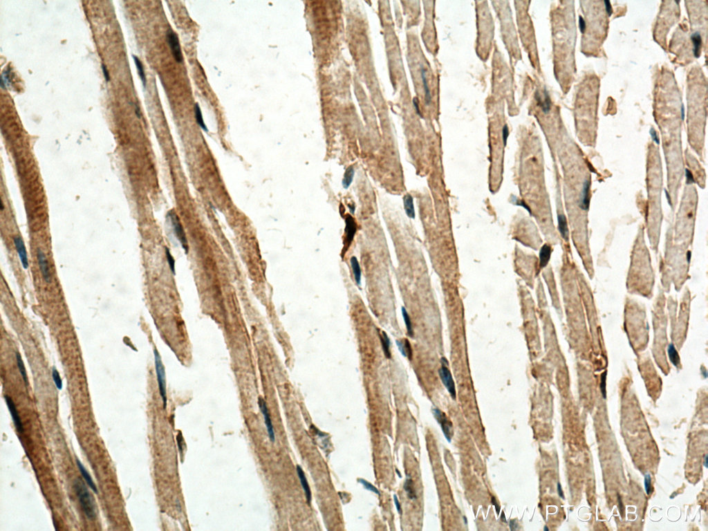 SERTAD1 Polyclonal antibody