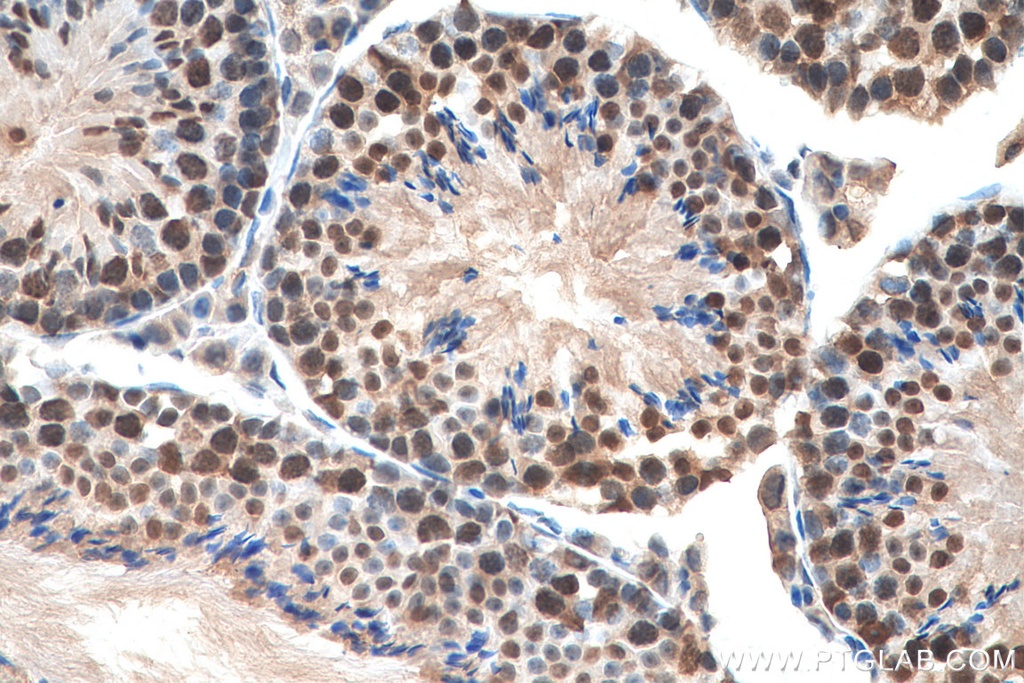 GTF2H1 Polyclonal antibody