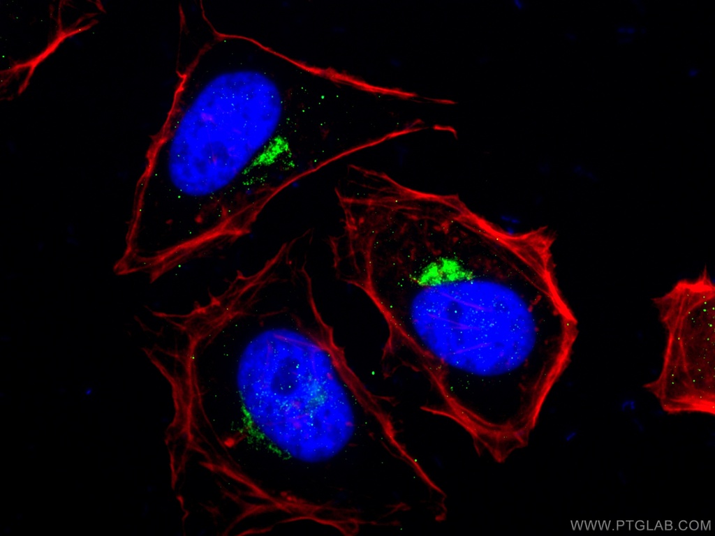 RAB6A Polyclonal antibody