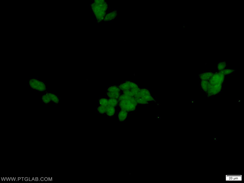 DFF45/DFFA Polyclonal antibody