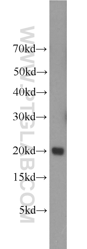 UBE2V1 Polyclonal antibody