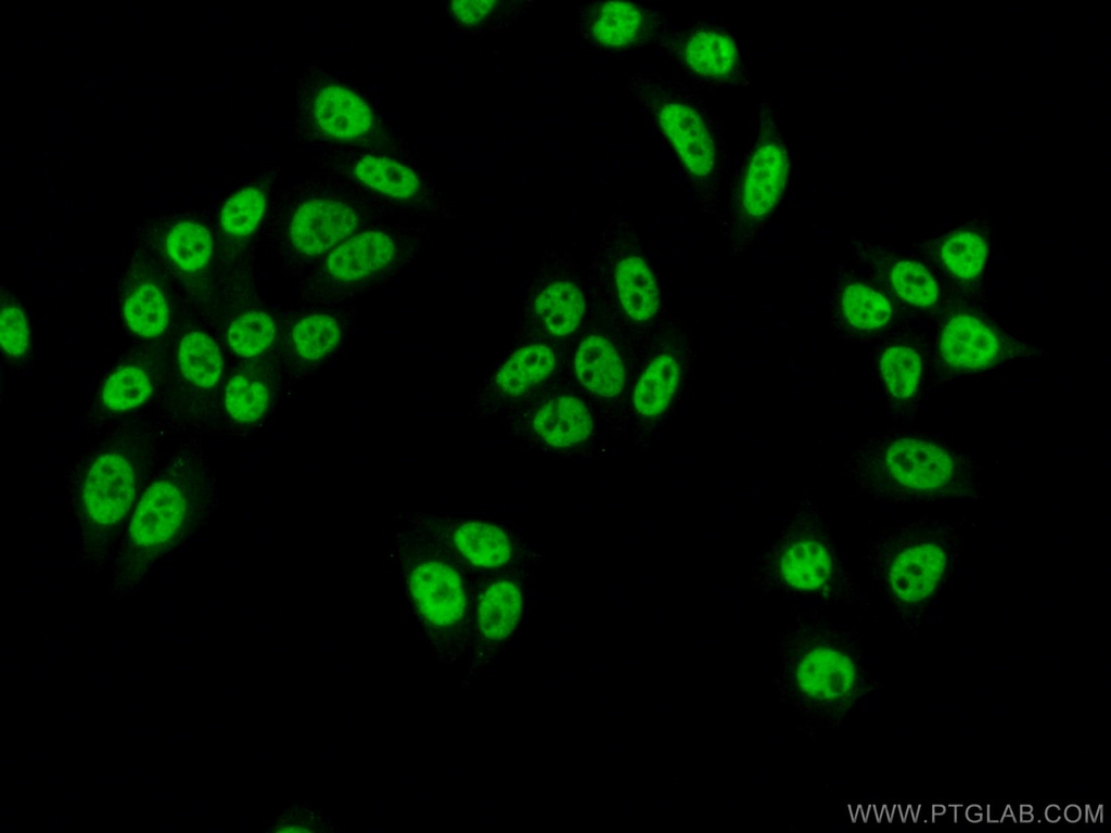 SNRPA Polyclonal antibody