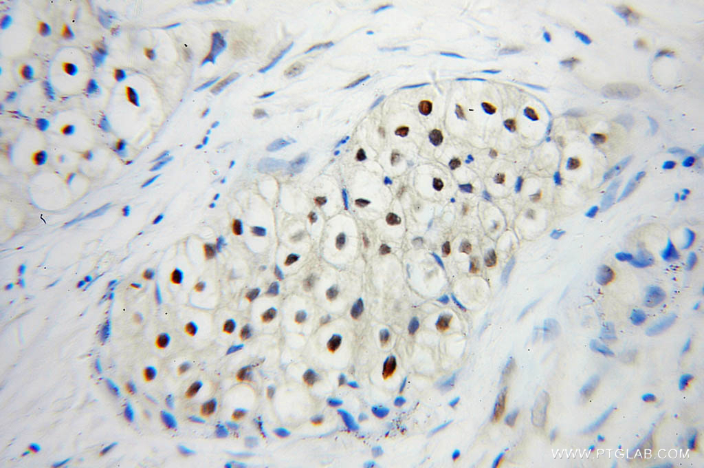 UBC9 Polyclonal antibody