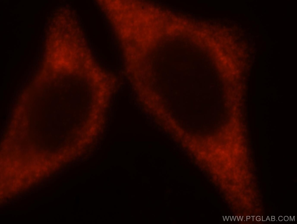 EIF2S2 Polyclonal antibody