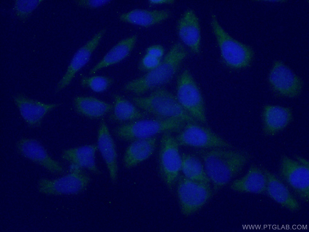 PLEKHA1 Polyclonal antibody