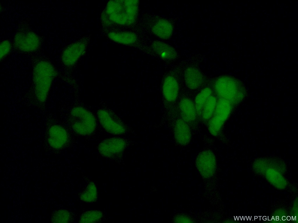 CBX1 Polyclonal antibody