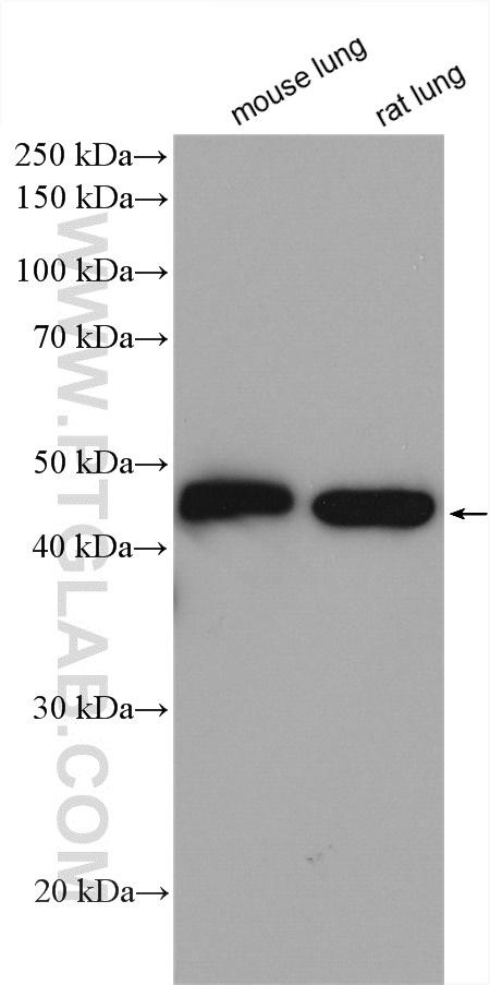 Gamma Actin Polyclonal antibody