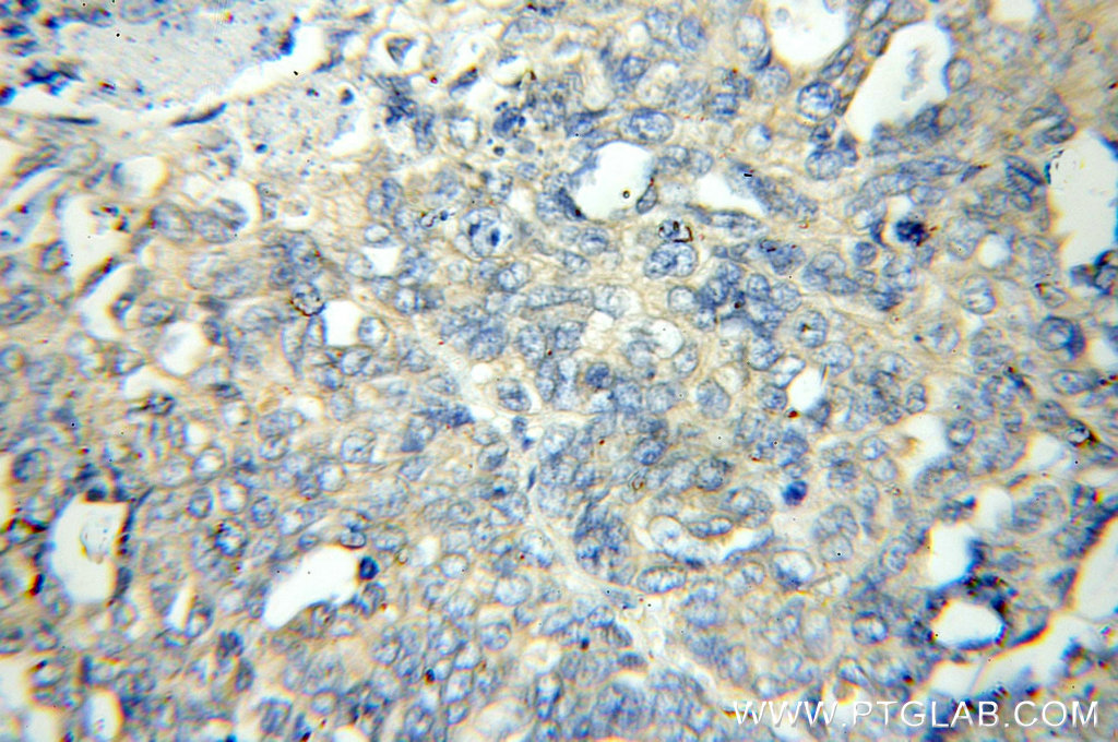 FLCN Polyclonal antibody
