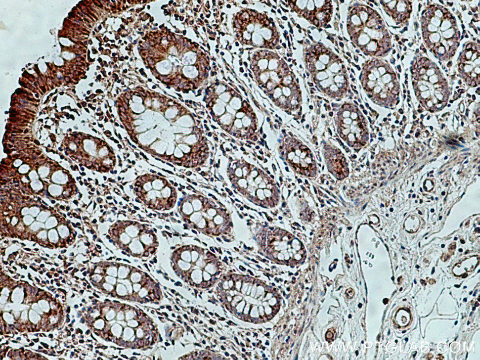 MIRO2 Polyclonal antibody