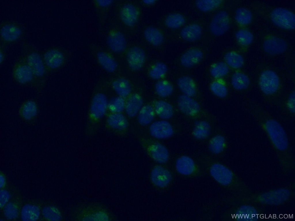 SCYL3 Polyclonal antibody