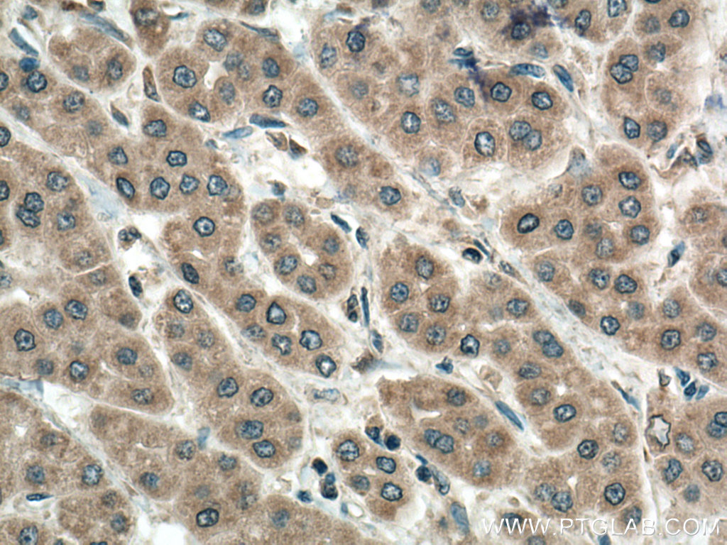 PMM1 Polyclonal antibody