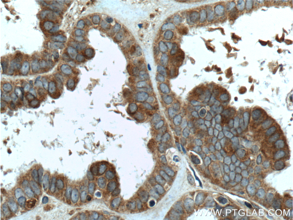 FMN2 Polyclonal antibody