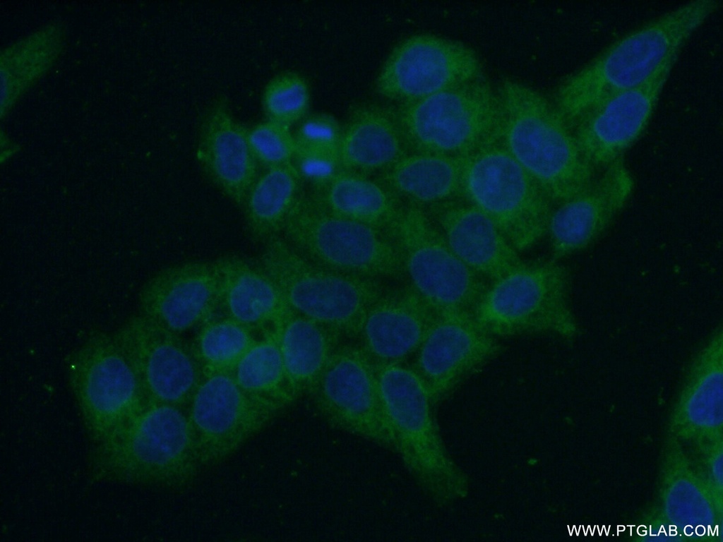 ERO1LB Polyclonal antibody
