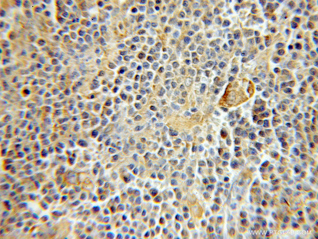 RMP Polyclonal antibody