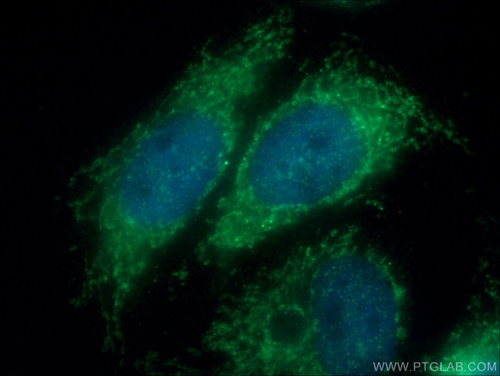 Tom22 Polyclonal antibody