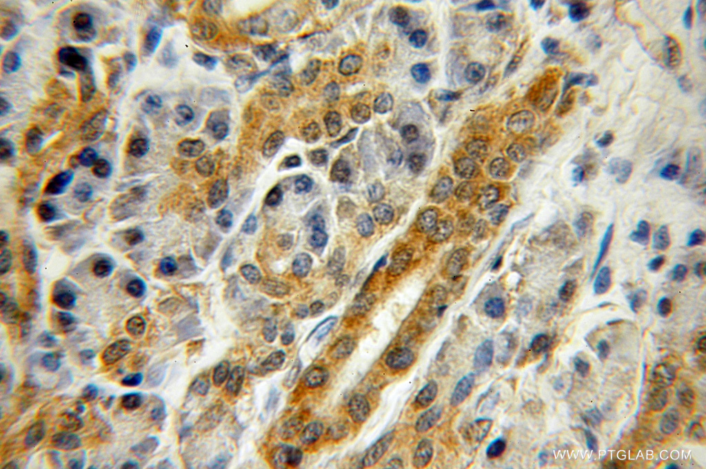 ZNF2 Polyclonal antibody